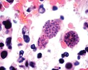 Could toxoplasmosis have a role in mammal declines?